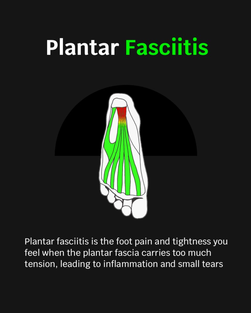 AVOS Therapy Slides⁠ come with a set of three semi-soft, ball shaped inserts of differing heights, designed to simulate the highly recommended tennis ball stretch. We turn the chore of this practice into an easy, 5-15 minute mobile foot massage that helps you stay active.