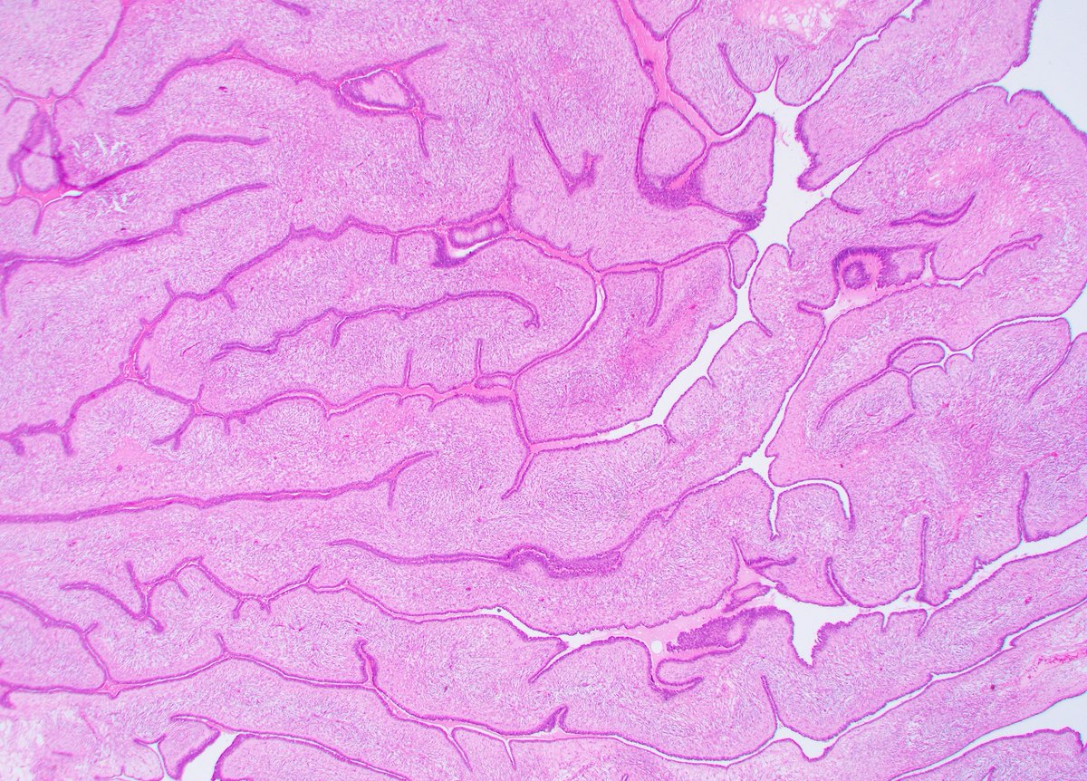 fouad_boulos's tweet photo. Is it breast or is it brain? 😋

#breastpath #PathTwitter #PathX @wusm_pathology @washupathedu https://t.co/sEmeuLMQxs