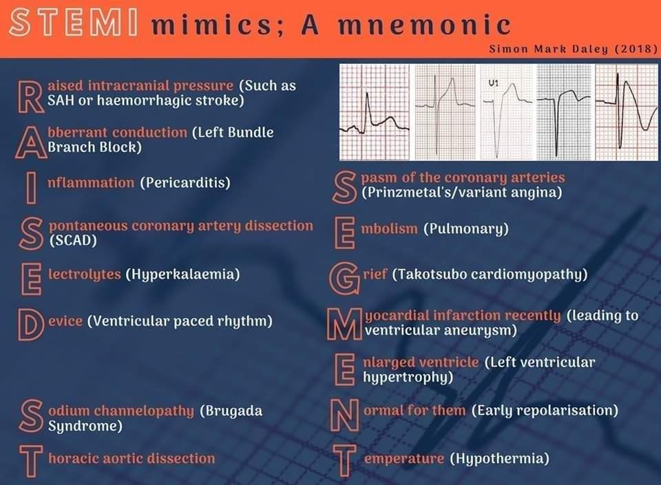 ZHeart11768530's tweet photo. 🔴 Causes of ST Elevation: ABCD ELEVATION.   
👉Other mnemonic can also be used. 

#MedEd #paramedic #CardioTwitter #ECG  #CardioEd #cardiology #medtwitter #ekg  #cardiotwiteros #medstudent https://t.co/O9feGjmDyq