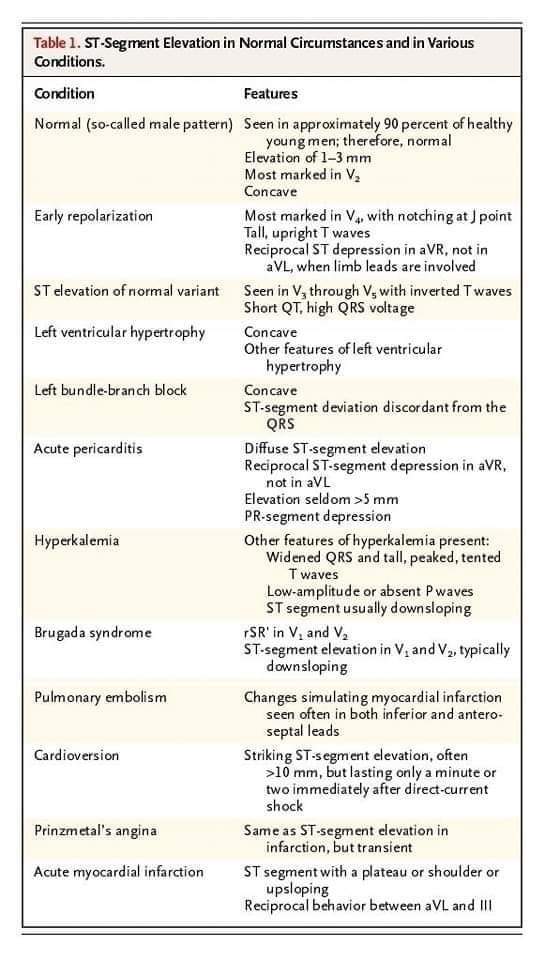 ZHeart11768530's tweet photo. 🔴 Causes of ST Elevation: ABCD ELEVATION.   
👉Other mnemonic can also be used. 

#MedEd #paramedic #CardioTwitter #ECG  #CardioEd #cardiology #medtwitter #ekg  #cardiotwiteros #medstudent https://t.co/O9feGjmDyq