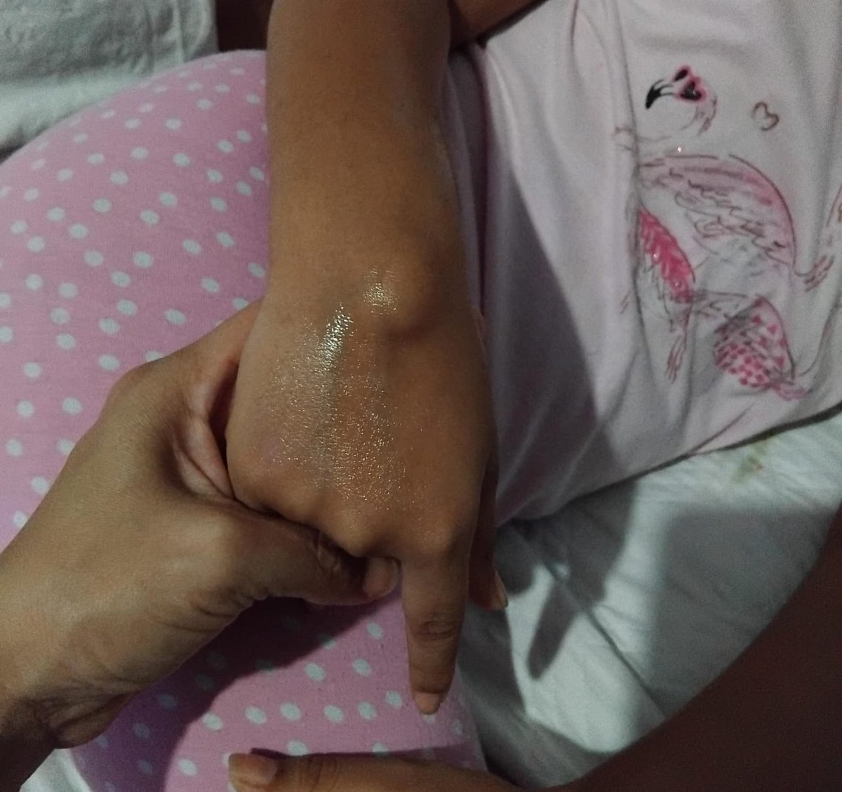 CandelariaAcuna's tweet photo. Me acaban de llamar de la @merced_clinica que hay fecha de operación de mi hija de un gran ganglión que no la deja realizar muchas actividades y que le genera dolor y me encuentro con la sorpresa que @epssura no ha autorizado, @Supersalud @petrogustavo https://t.co/kvNrJdo45i