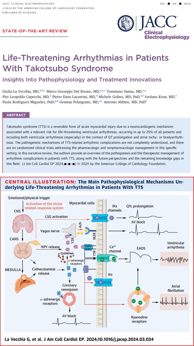 New insights on life-threatening arrhythmias in Takotsubo Syndrome. Explore the complex mechanisms and innovative treatments. 
🇮🇹🇺🇸

Link: sciencedirect.com/science/articl…

<a href="/giulialavecchi3/">giulia_lavecchia</a> <a href="/MarcoDelBuono3/">Marco Del Buono</a> <a href="/Prodrmig/">Paula Rodriguez Miguelez</a> <a href="/jordanakron1/">Jordana Kron</a> <a href="/tommasosanna_MD/">Tommaso Sanna</a> <a href="/AbbateAntonio/">AntonioAbbate</a>