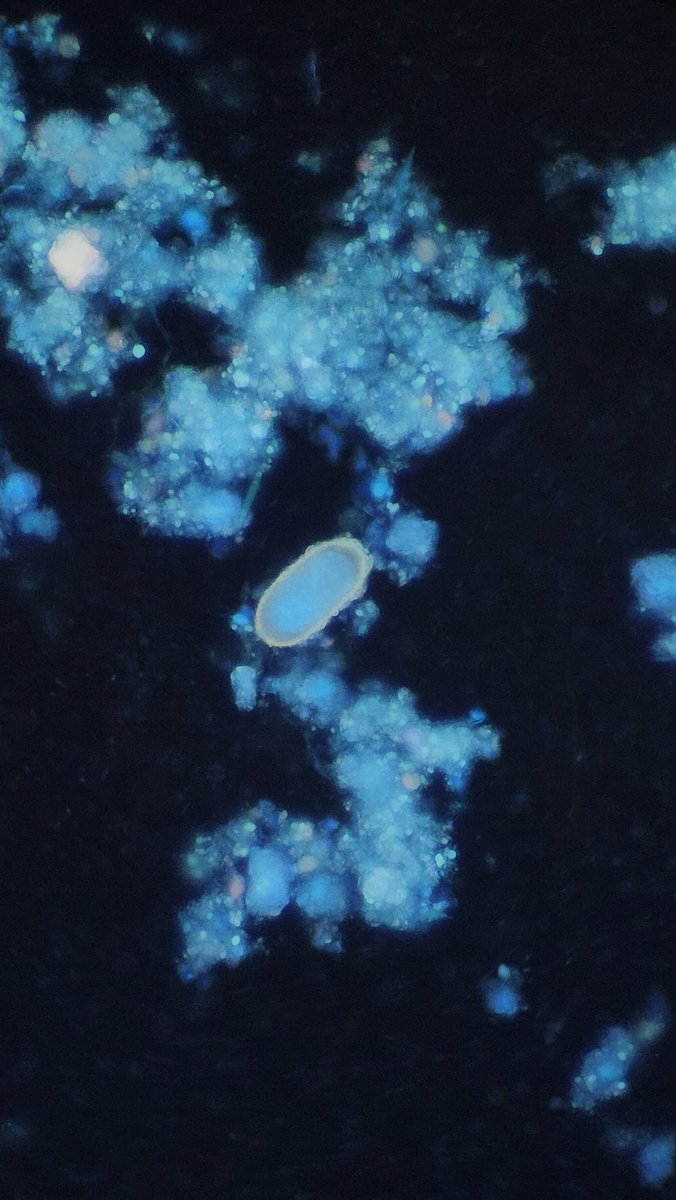 I was just inspired to get off my butt and share some more images on here by a colleague at ACLPS 2024 😉
UV image of Paracapillaria in a stool specimen.
#parasitology <a href="/ParasiteGal/">Bobbi Pritt, MD</a> <a href="/ARUPLabs/">ARUP Laboratories</a>