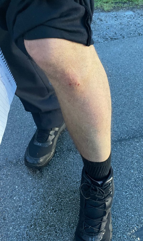kclairerogers's tweet photo. There was always one kid in your class who got a cut like this at recess, went to the nurse for a band aid and then limped for the next 3-5 business days https://t.co/QK2O0ykmNN