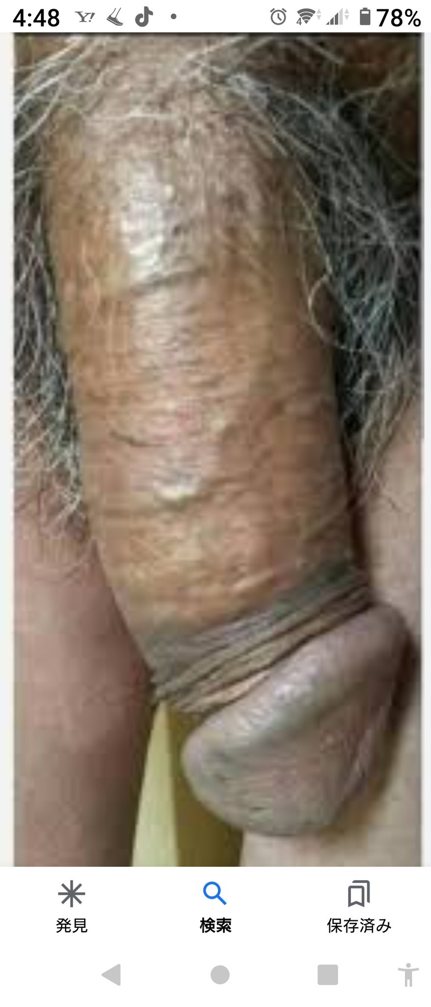 チンポ ズルムケ 