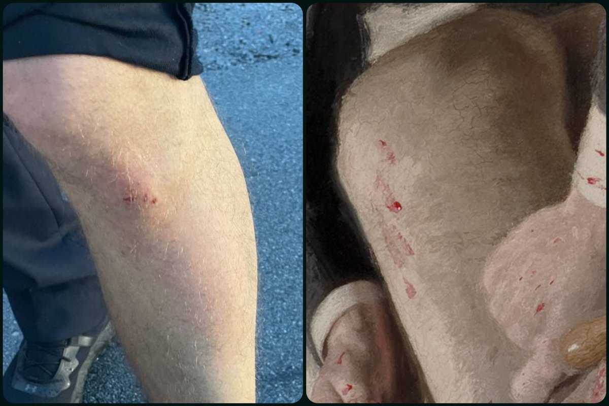 <a href="/LachTalk/">Lachlan McLean 📺</a> zoomed &amp; rotated view of The Gross Clinic, by Thomas Eakins, 1875, 📸 via <a href="/LMPD/">LMPD</a>