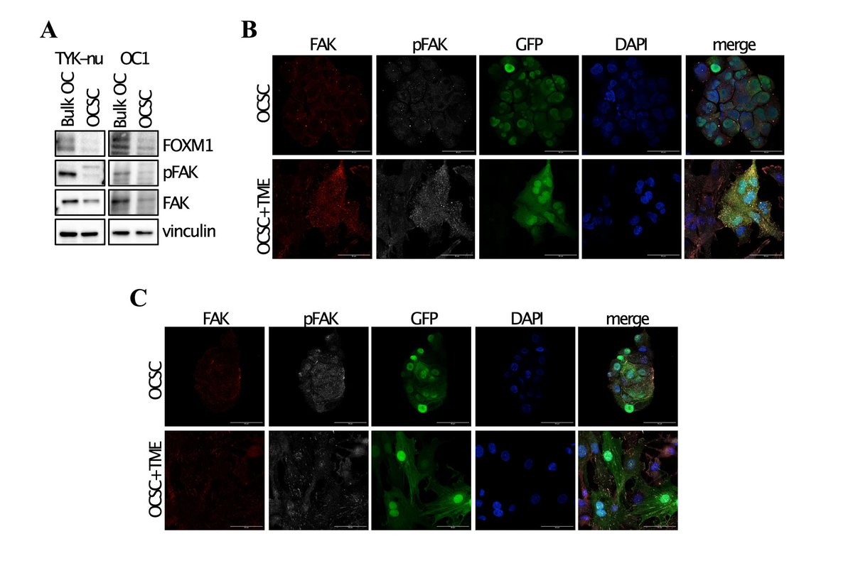 A <a href="/IEOufficiale/">IEO</a> team including Dr. Chiara Battistini discovered that the pro-tumorigenic transcription factor FOXM1🦊 is specifically induced by the microenvironment in #OvarianCancer stem cells, through activation of FAK/YAP signaling. 
go.nature.com/4aSAaoW