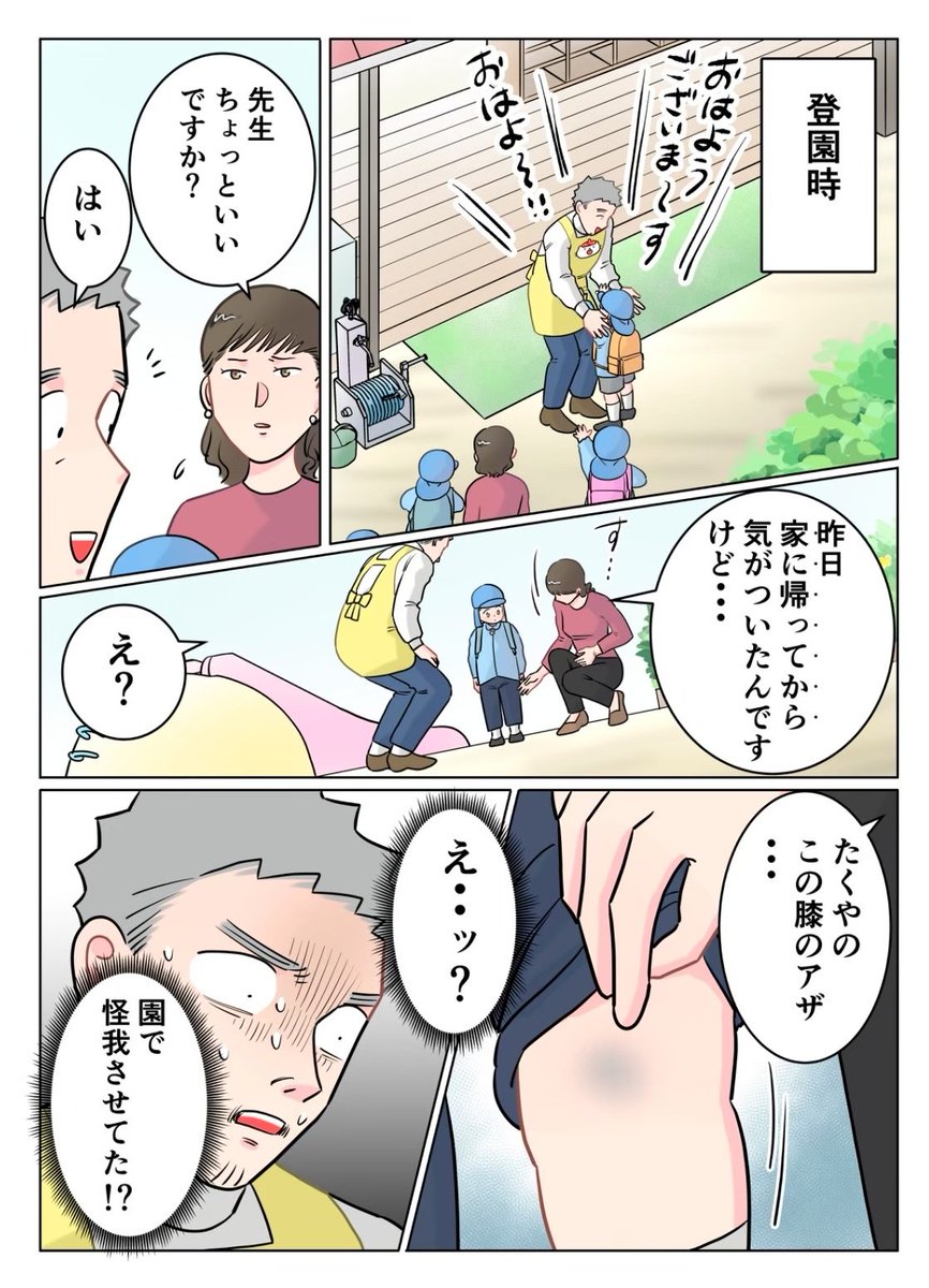 Dekopon_56's tweet photo. ただいま！　保育士　でこ先生

第33話　謎のアザ https://t.co/nqaJBuGS2W