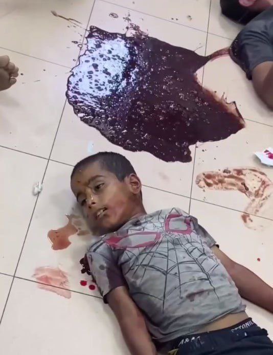 Şu an Nusayratta yaşananları tarif etmek imkansız, şehitler her yerde.

Her yeri bombalıyorlar herkesi öldürüyorlar