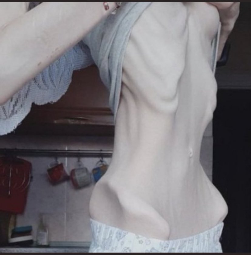 bunsbonez's tweet photo. idk which body i want to aim for https://t.co/yJMmi66xm3