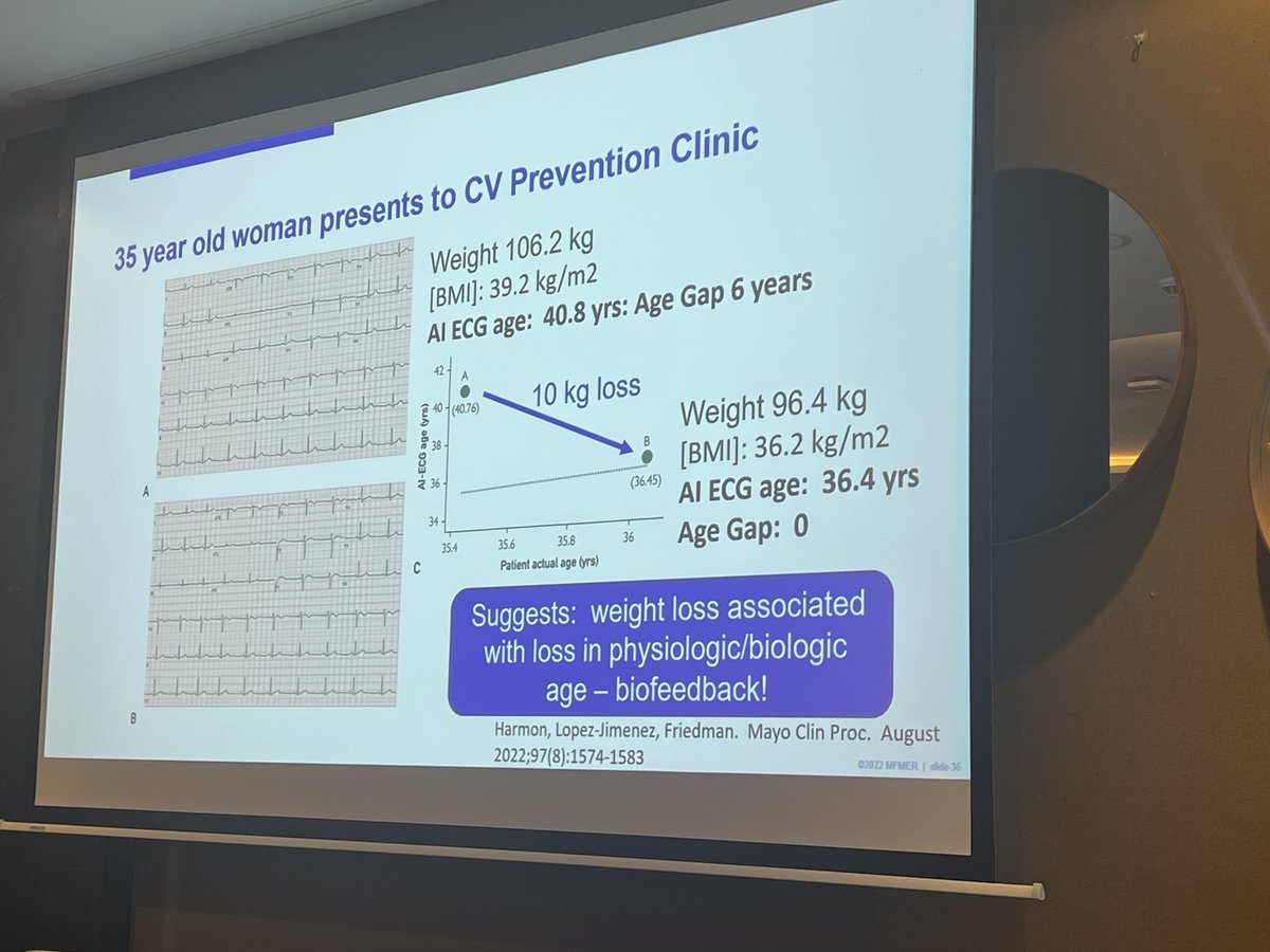 Dominik Linz (@dominik_linz) on Twitter photo #AtrialSignals
@drpaulfriedman
This is interesting:
Weight-loss reduces AI-ECG derived age by almost 4 years…
And:
…corrects for the initial age gap (AI ECG age - chronological age)!
<a href="/PrashSanders/">Prash Sanders</a> <a href="/J_Hendriks1/">Jeroen Hendriks</a> <a href="/Elliott_AD/">Adrian Elliott</a> <a href="/melissaemm1/">Melissa Middeldorp</a>
<a href="/Dominik_Linz/">Dominik Linz</a>, <a href="/UliSchotten/">Uli Schotten</a>, #AtrialSignals
@drpaulfriedman
This is interesting:
Weight-loss reduces AI-ECG derived age by almost 4 years…
And:
…corrects for the initial age gap (AI ECG age - chronological age)!
<a href="/PrashSanders/">Prash Sanders</a> <a href="/J_Hendriks1/">Jeroen Hendriks</a> <a href="/Elliott_AD/">Adrian Elliott</a> <a href="/melissaemm1/">Melissa Middeldorp</a>
<a href="/Dominik_Linz/">Dominik Linz</a>, <a href="/UliSchotten/">Uli Schotten</a>,