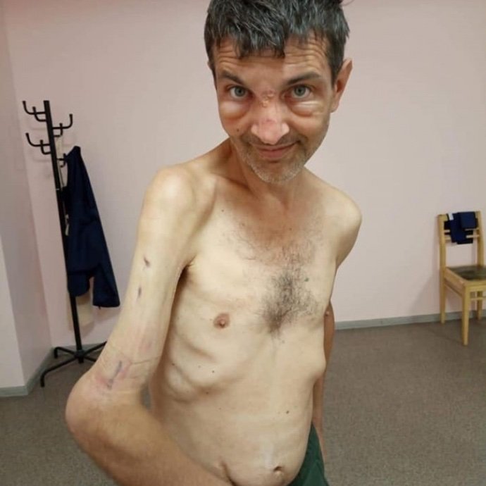 MrGbengaaa's tweet photo. Ukrainian soldiers before and after Russian captivity:

1. Mykhailo Dianov https://t.co/VyDz8eoPpG