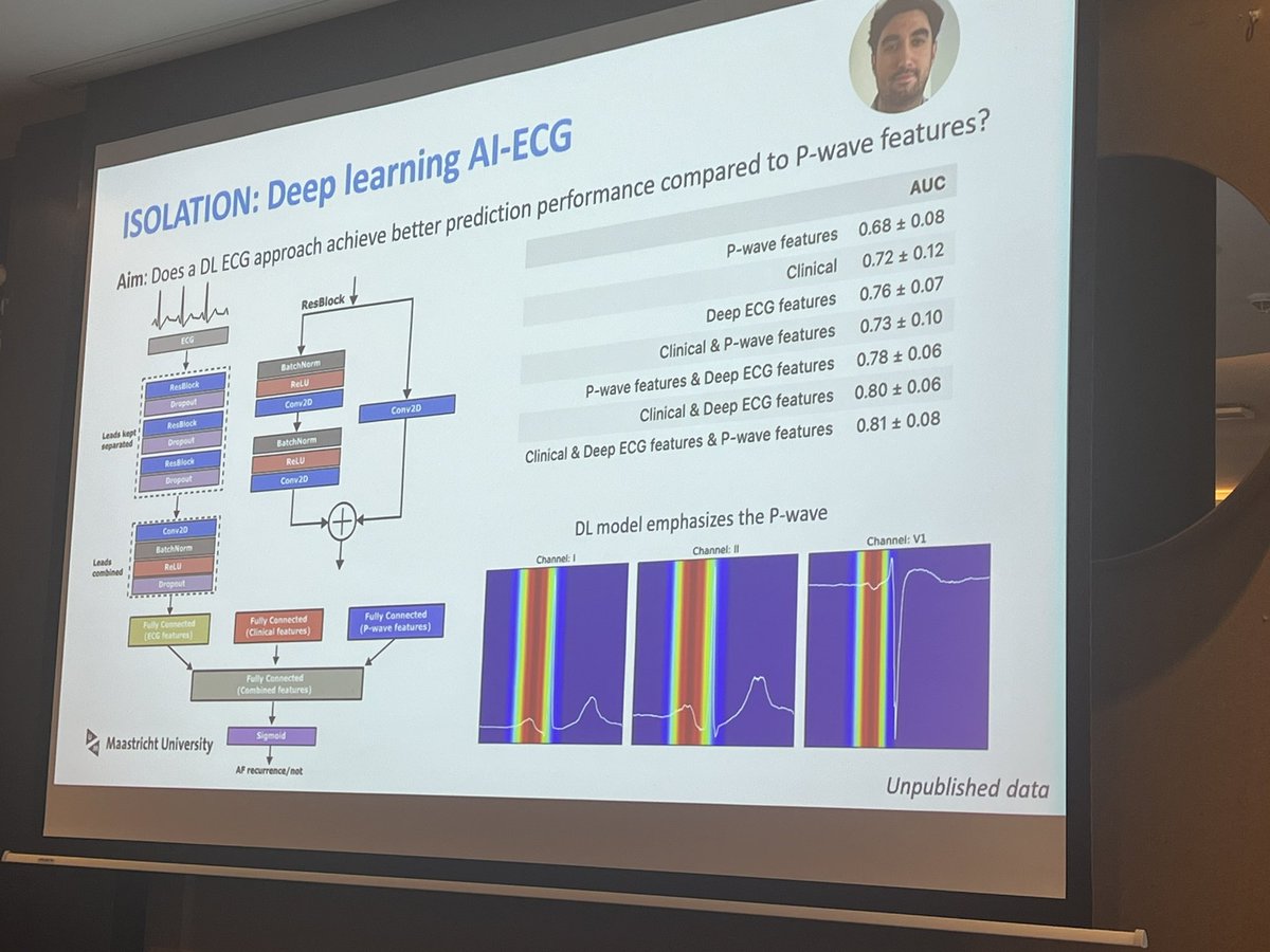 Dominik Linz (@dominik_linz) on Twitter photo #AtrialSignals
ECG-derived prediction of AF-recurrence after AF ablation…
- from the assessment of F-waved to #AI enabled extended ECG
Also utilizing our #ISOLATION study 📚
📖frontiersin.org/articles/10.33…
<a href="/DoVerhaert/">Dominique Verhaert</a> <a href="/ZarinaHabibi/">Zarina Habibi</a>
<a href="/Dominik_Linz/">Dominik Linz</a>, <a href="/UliSchotten/">Uli Schotten</a>, <a href="/JolandaGulpen/">Jolanda Gulpen</a>, #AtrialSignals
ECG-derived prediction of AF-recurrence after AF ablation…
- from the assessment of F-waved to #AI enabled extended ECG
Also utilizing our #ISOLATION study 📚
📖frontiersin.org/articles/10.33…
<a href="/DoVerhaert/">Dominique Verhaert</a> <a href="/ZarinaHabibi/">Zarina Habibi</a>
<a href="/Dominik_Linz/">Dominik Linz</a>, <a href="/UliSchotten/">Uli Schotten</a>, <a href="/JolandaGulpen/">Jolanda Gulpen</a>,