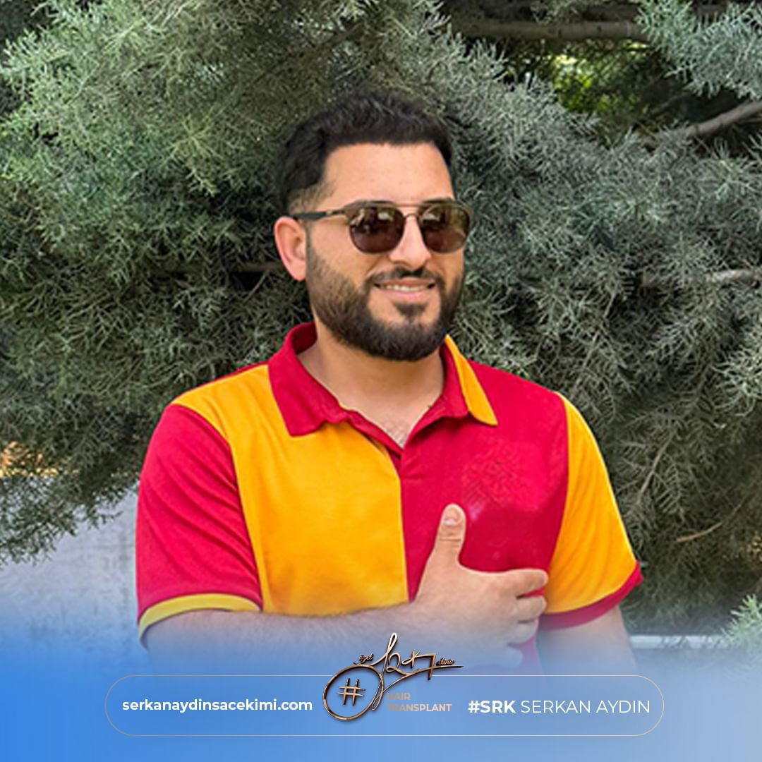 Arenamedd's tweet photo. Die perfekte Verwandlung unseres Patienten in 10 Monaten 🤩
#canahmetkılınç
Kontaktieren Sie uns für eine Haaranalyse 📱

#serkanaydin #maximumgrafts #hairtransplant #beardtransplant #stemcell #haartransplant #Stammzellen #maximalgraft #maximaktransplantation #barttransplant https://t.co/e7pagB81GA