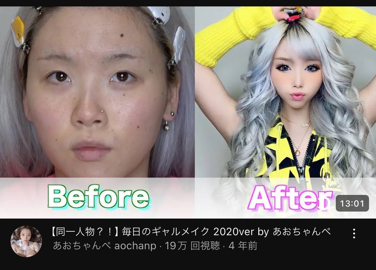 これがこれになるの冷静にすごくない？！！ (全写真無加工) 保険適用の