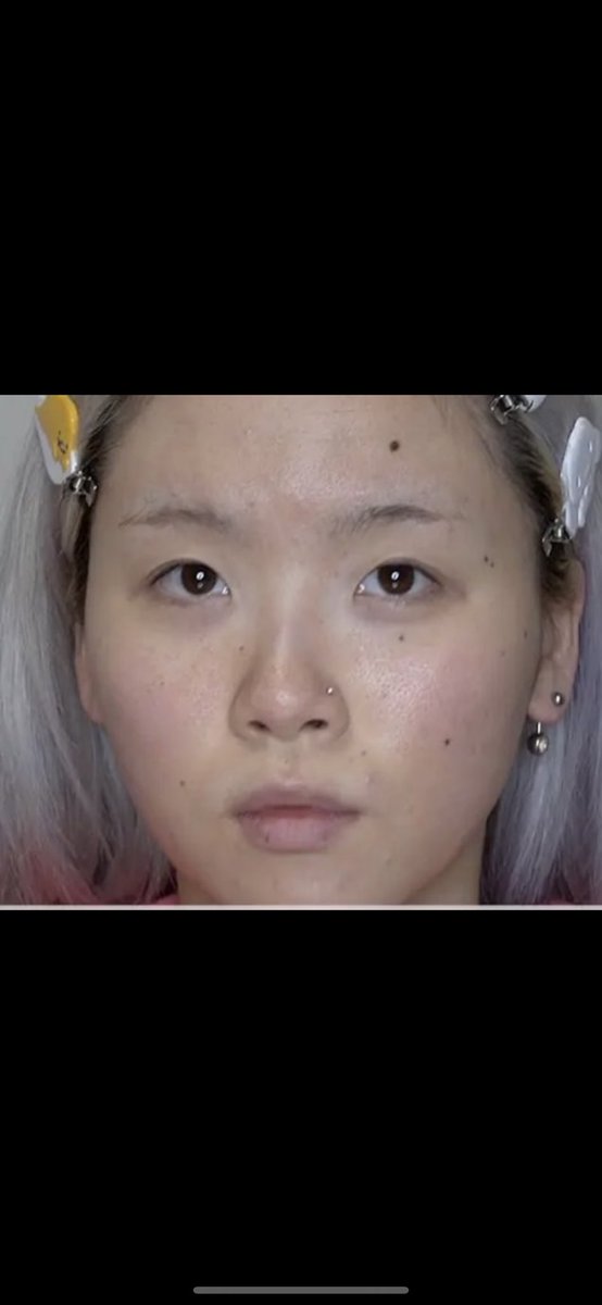 これがこれになるの冷静にすごくない？！！ (全写真無加工) 保険適用の