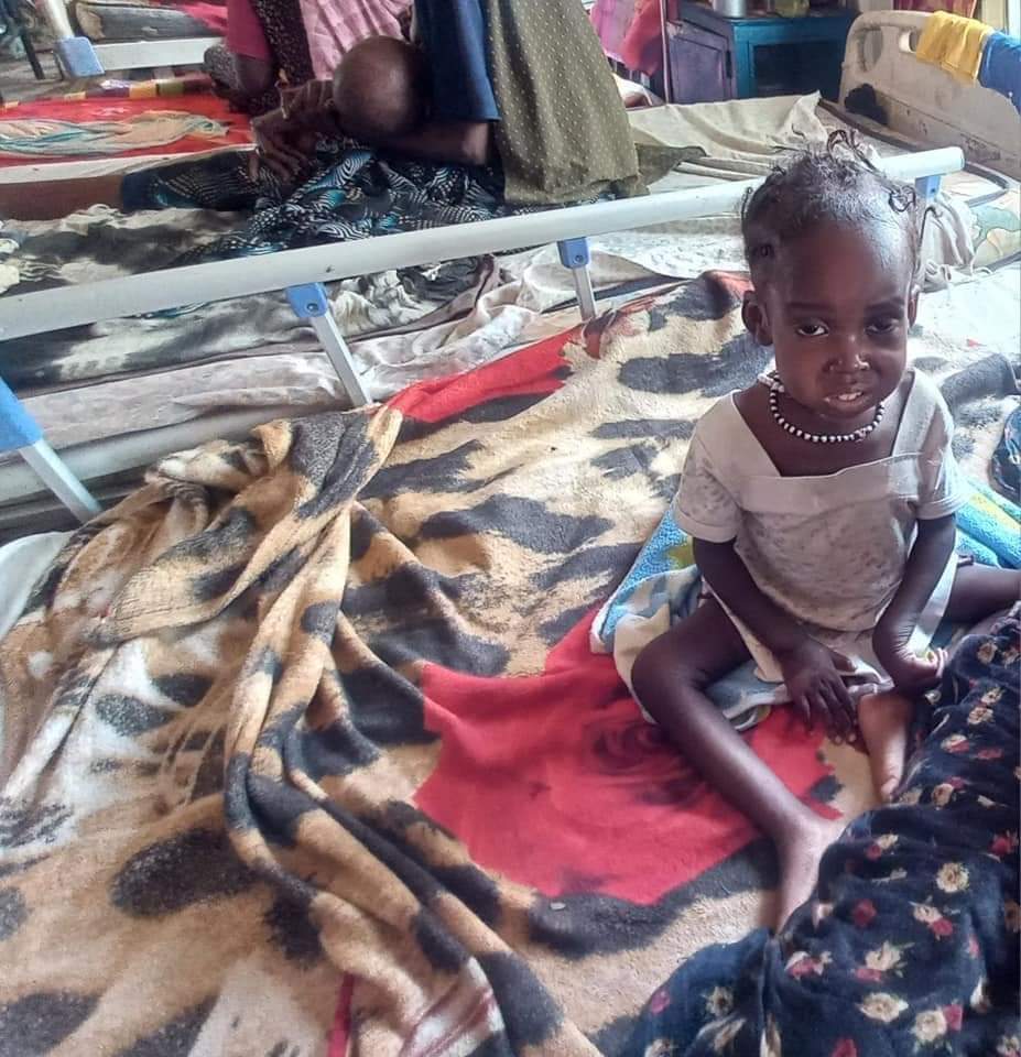 صور تصف معاناة الأطفال من سوء التغذية الحاد وحالتهم بين الألم والموت السريري، #بمعسكر #كلمة بولاية جنوب دارفو 
 Pictures describing children suffering from severe malnutrition and their condition between pain and clinical death, in Kalma camp in South Darfur