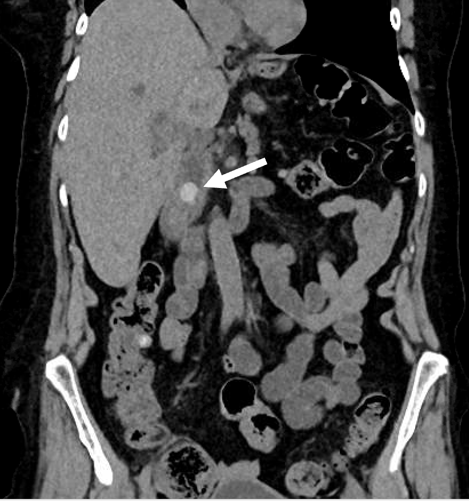 Ezra Teitelbaum tweet media