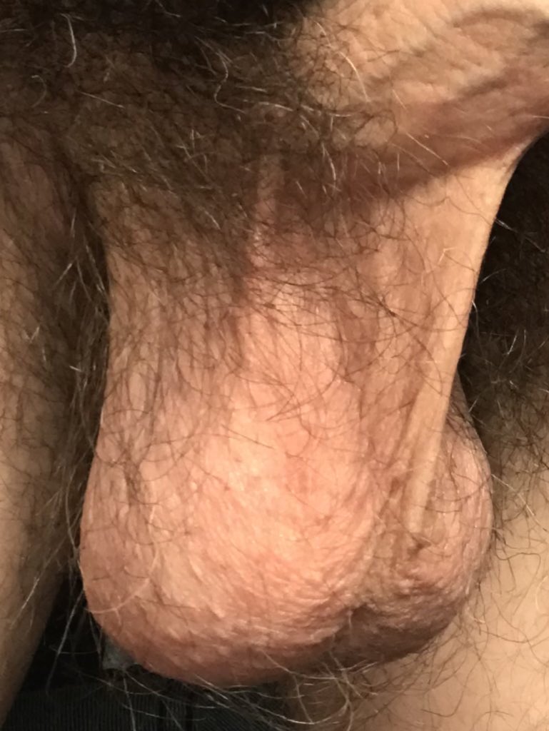 swollencocklad's tweet photo. Nads https://t.co/ZsnnqDFIpv