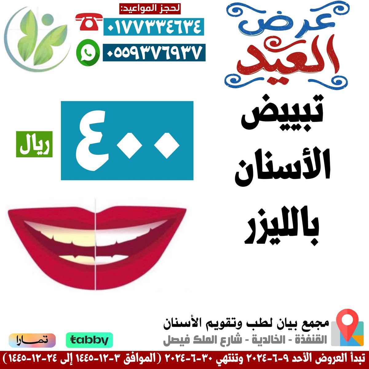 bien3tre's tweet photo. عروض العيد لأحلى ابتسامة🤍✨
للاستفسارات والمواعيد
▫️الاتصال على الاستقبال مباشرة عبر الثابت:
0177334634
▫️التواصل عبر وتساب الاستقبال:
0559376937

⭕️ *في أوقات الدوام* ⭕️
✅ السبت إلى الخميس:
٨:٠٠ صباحا ⬅️ ١١:٠٠ ليلا
✅الجمعة:
٢:٠٠ ظهرا ⬅️ ١١:٠٠ ليلا https://t.co/BL9XNYnVkY