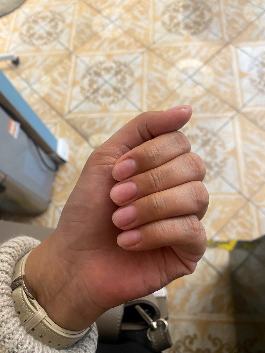 olyayadreeva's tweet photo. клянусь больше никакого шеллака в моей жизни 🥲 так хорошо мне стало https://t.co/m6GRlokVcN