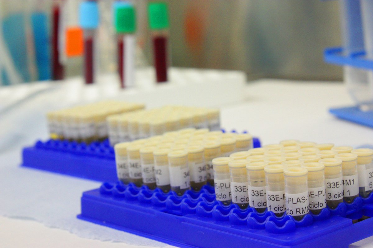 GVA Fisabio (@gvafisabio) on Twitter photo ➡️ El Biobanco IBSP-CV de <a href="/GVAsanitat/">GVA Sanitat</a> pone a disposición de la comunidad científica una valiosa colección de muestras biológicas:
🧬 52 muestras de ADN
💉 113 muestras de plasma
💧 99 muestras de suero
🔬 122 muestras de tejido tumoral ➡️ El Biobanco IBSP-CV de <a href="/GVAsanitat/">GVA Sanitat</a> pone a disposición de la comunidad científica una valiosa colección de muestras biológicas:
🧬 52 muestras de ADN
💉 113 muestras de plasma
💧 99 muestras de suero
🔬 122 muestras de tejido tumoral
