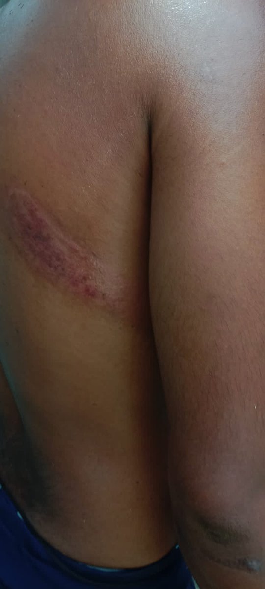 hindupost's tweet image. Horrific news coming from #WestBengal
As per the received information so far, it is evident that Anti-BJP violence has turned into Anti-Hindu violence in the #Coochbehar district. 
Islamists allegedly attacked the homes of BJP workers in Kajlikura village under the Sitai Assembly