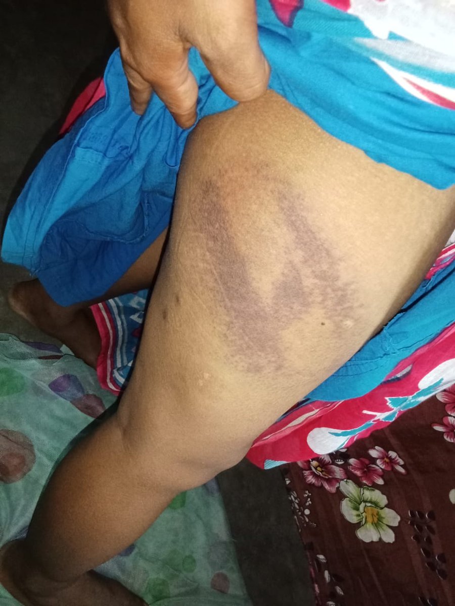 hindupost's tweet image. Horrific news coming from #WestBengal
As per the received information so far, it is evident that Anti-BJP violence has turned into Anti-Hindu violence in the #Coochbehar district. 
Islamists allegedly attacked the homes of BJP workers in Kajlikura village under the Sitai Assembly