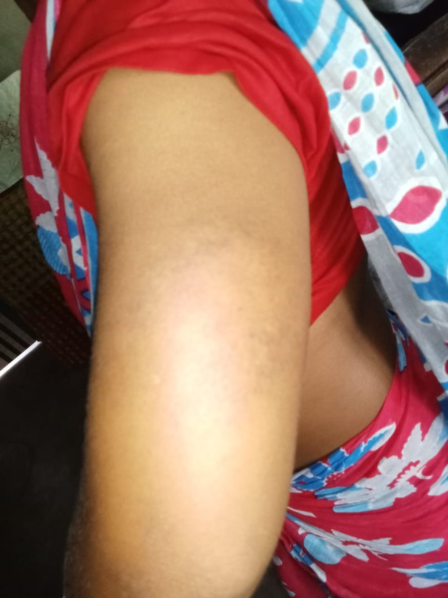 hindupost's tweet image. Horrific news coming from #WestBengal
As per the received information so far, it is evident that Anti-BJP violence has turned into Anti-Hindu violence in the #Coochbehar district. 
Islamists allegedly attacked the homes of BJP workers in Kajlikura village under the Sitai Assembly