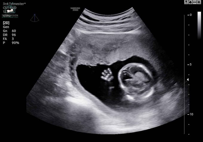 My son said hey https://t.co/uMppbJ9MFe