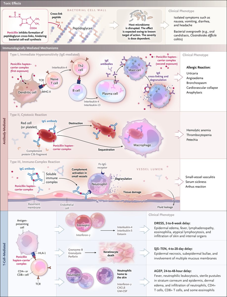 ✨Clinical Manifestations and Mechanisms of Penicillin Allergy

⚠️IgE-mediated reactions (Gell–Coombs type I)
➡️require prior exposure and sensitization
➡️~10% lose their specific IgE (i.e.sensitivity) each year
➡️alternative β-lactams not contraindicated

doi.org/10.1056/nejmra…