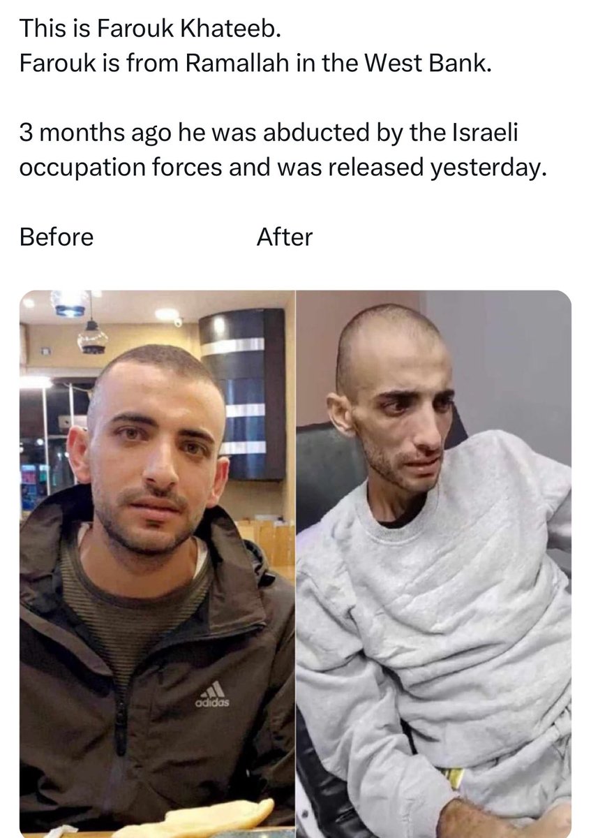 no_soy_banski's tweet photo. @IsraelinSpanish Me alegro que TODOS los secuestrados lleguen a casa sanos 

PD - Encuentra las diferencias en el estado de salud del cautiverio .. ¿Quién trata mejor a los prisioneros? https://t.co/ZjQifxzw7F