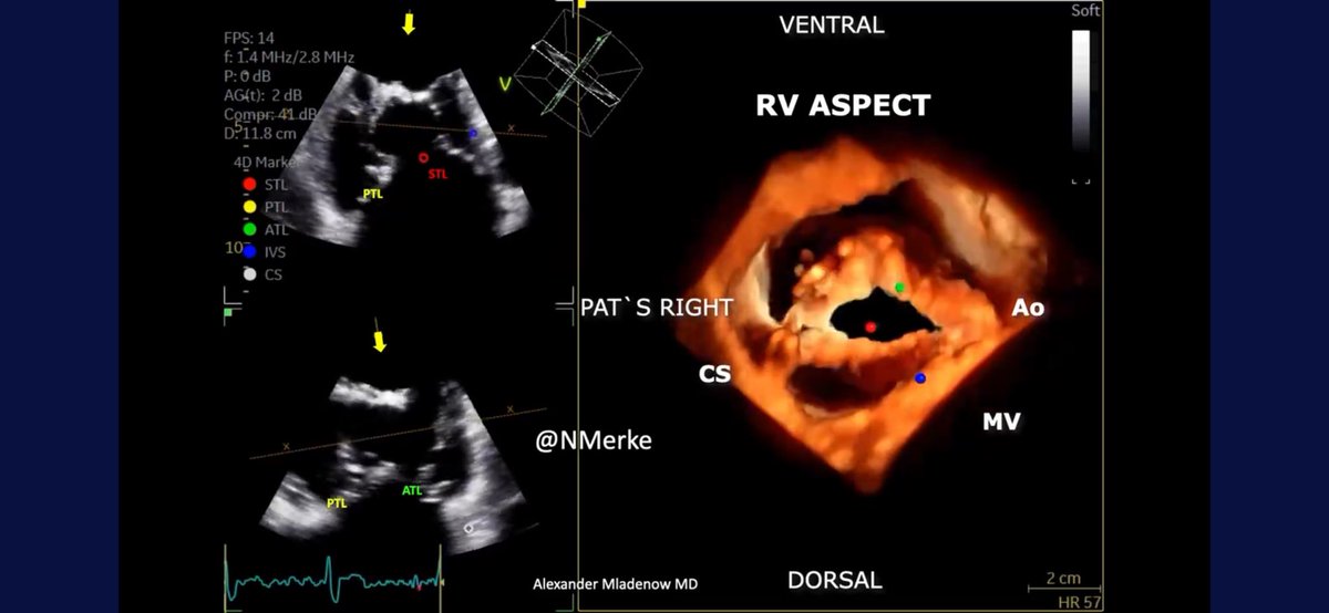 NMerke's tweet photo. What an honor I received. 
Got an invitation from #SoCal 
#LLUH to deliver an #echofirst talk entitled: 
🫶 3D Echocardiography: Art and Application” 
Thank you from the bottom of my heart ❤️ @purviparwani https://t.co/QMej1mVVjC