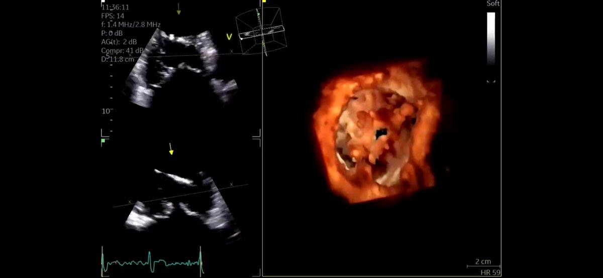 NMerke's tweet photo. What an honor I received. 
Got an invitation from #SoCal 
#LLUH to deliver an #echofirst talk entitled: 
🫶 3D Echocardiography: Art and Application” 
Thank you from the bottom of my heart ❤️ @purviparwani https://t.co/QMej1mVVjC