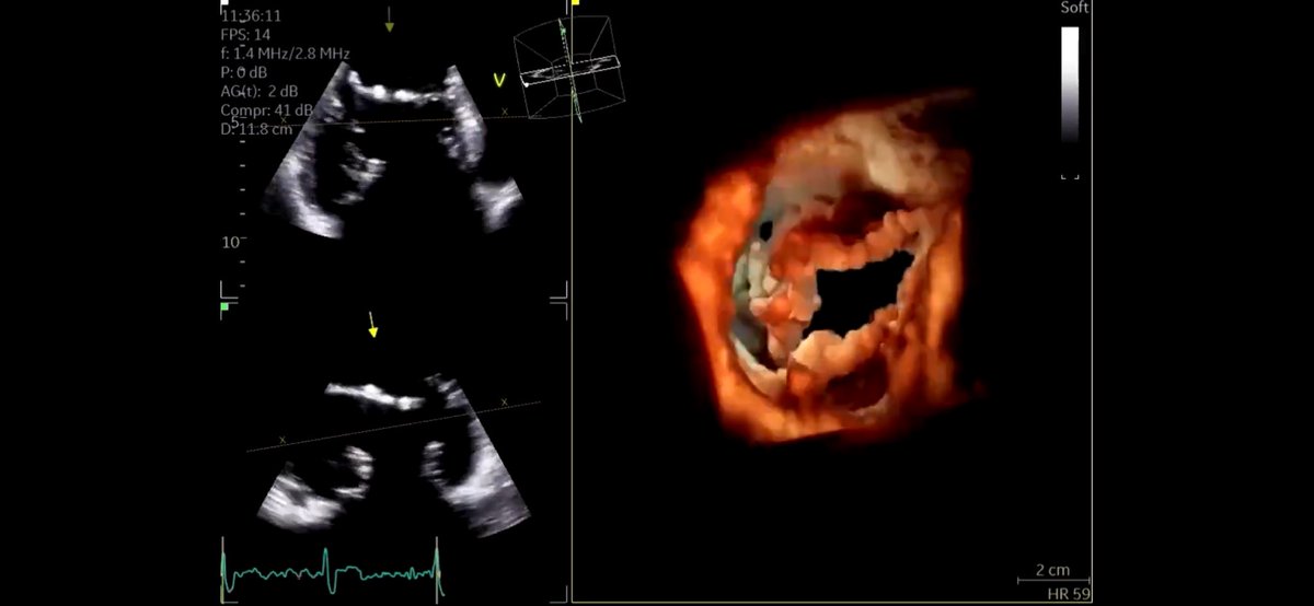 NMerke's tweet photo. What an honor I received. 
Got an invitation from #SoCal 
#LLUH to deliver an #echofirst talk entitled: 
🫶 3D Echocardiography: Art and Application” 
Thank you from the bottom of my heart ❤️ @purviparwani https://t.co/QMej1mVVjC