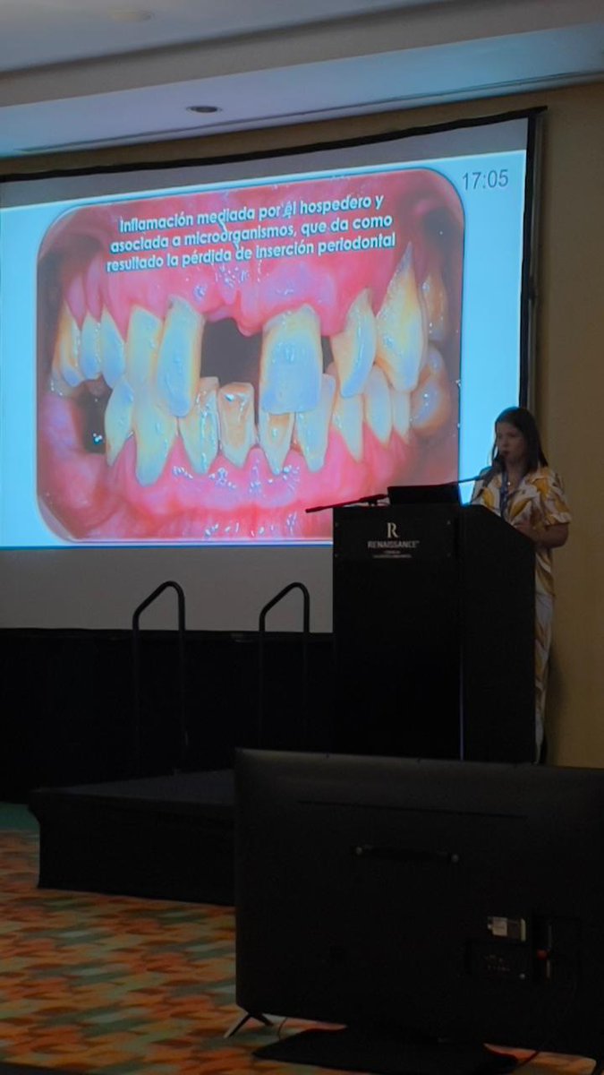svperiodoncia's tweet photo. Participación de la Dra. Ilusión Romero, Presidente de la  Comisión Científica de nuestra Sociedad, en el XIII Congreso Nacional de Diabetes 2024, con la conferencia "Estado de Salud Bucal, Conocimientos y Comportamientos de los Pacientes con Diabetes" https://t.co/uxNlOz0wtS