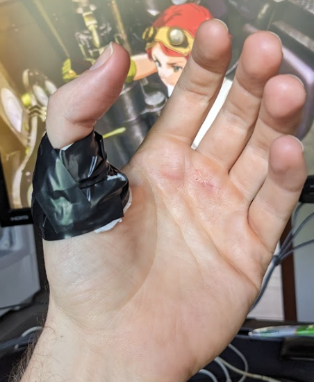 🥲 I swear, half of the time I think I just injure myself for the interesting stories. 
Machete done got me 🤺⚔️