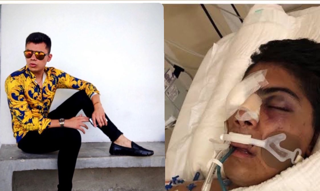 CarlettoJ21's tweet image. EN TW / EN C4
Dereck Sanchez
25 años
Andaba con una buchona apodado El Elviro.
Fue con ella a agredir a su exnovio de la secu pero acabo puteado por el ex.
Así acabó en urgencias en el IMSS

Detalles #C4EnAlerta
