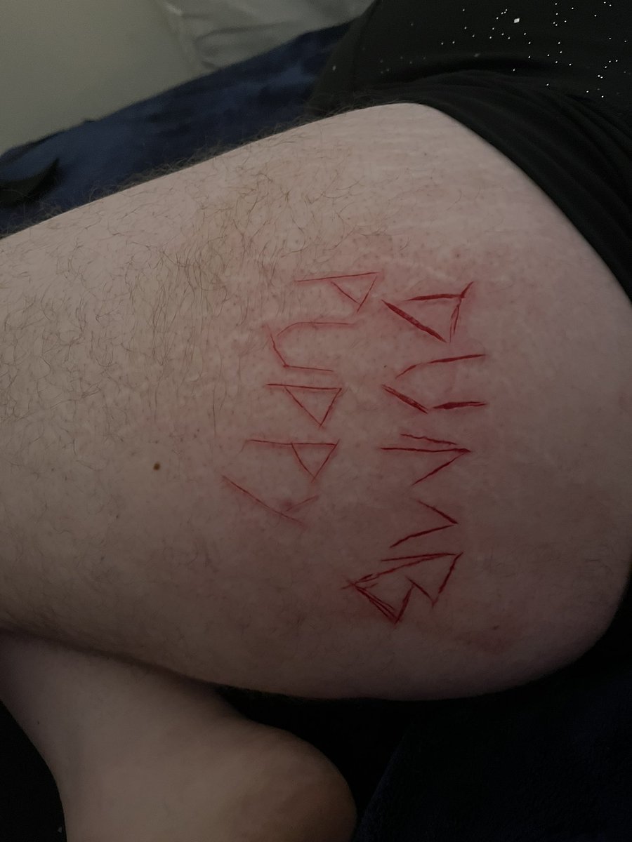 CandyLovingPup's tweet photo. Some friends carved into my leg tn and god it was so hot https://t.co/TYEmZnKPwa