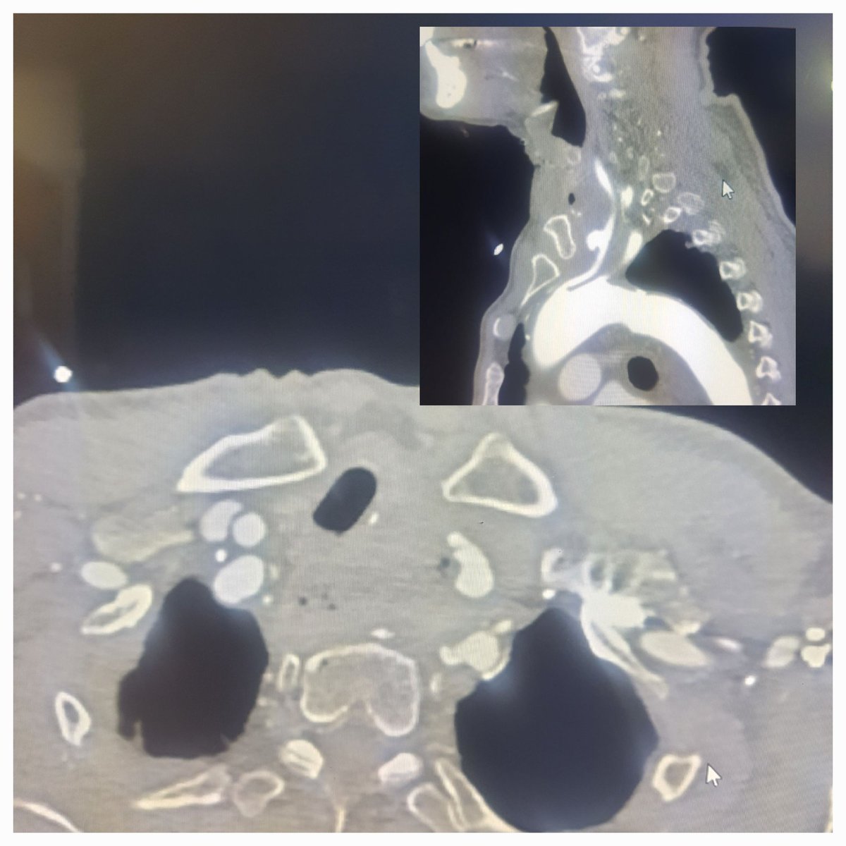 Dr Saurabh kumar Interventional radiologist tweet media