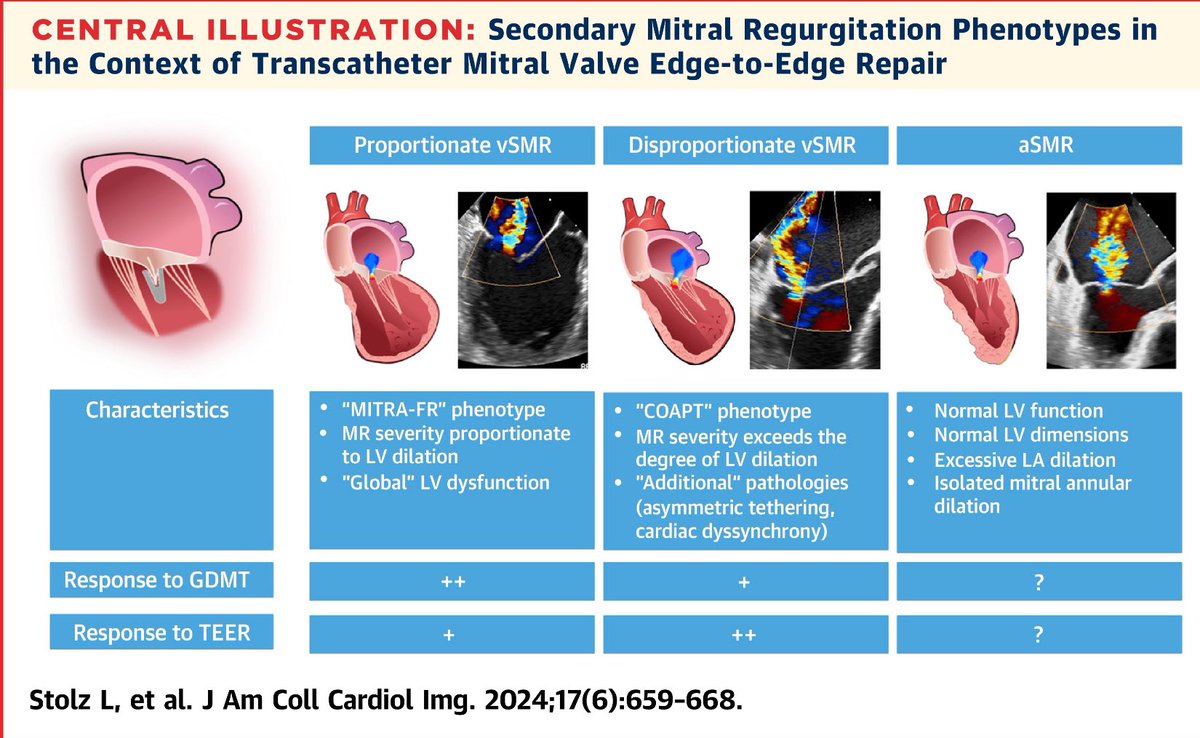 MAecocardio's tweet photo. 📣🔈Revisión imperdible !!!! https://t.co/QpPD4pg094
📍La regurgitación mitral secundaria es una entidad heterogénea que se presenta con diferentes fenotipos clínicos❗️❗️❗️
📍La diferenciación de los fenotipos de origen auricular y ventricular  (RMSa vs RMSv) y sus variantes son básicos para entender la respuesta al tratamiento médico e intervencionista