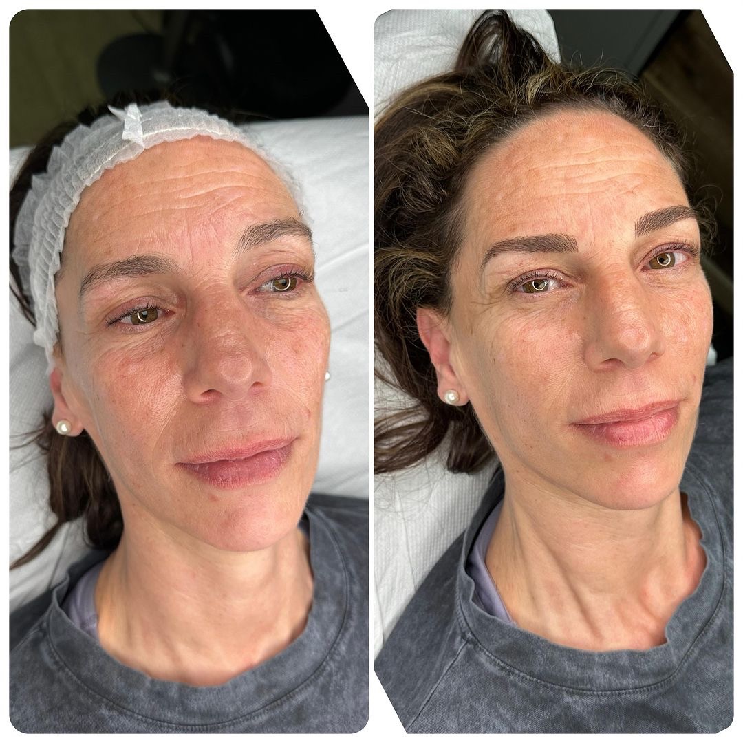 #microblading 100% natural
Consigue unas cejas perfectas con nuestro servicio de microblading
Reserva tu cita en el 645353520 y olvídate de tener que maquillarlas todos los días.