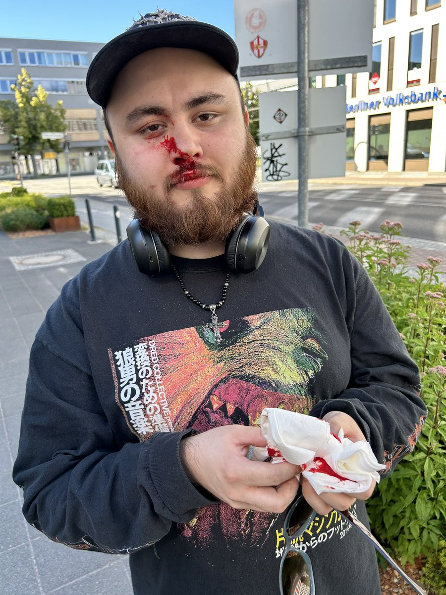 First fight of the split has already started. 

Got in a proper bang up with some KC fans. Apparently didn’t like my Pink Ward Floyd “Another Brick in The Blue Wall” T Shirt. 

I’ll be back. Watch out you bastards.