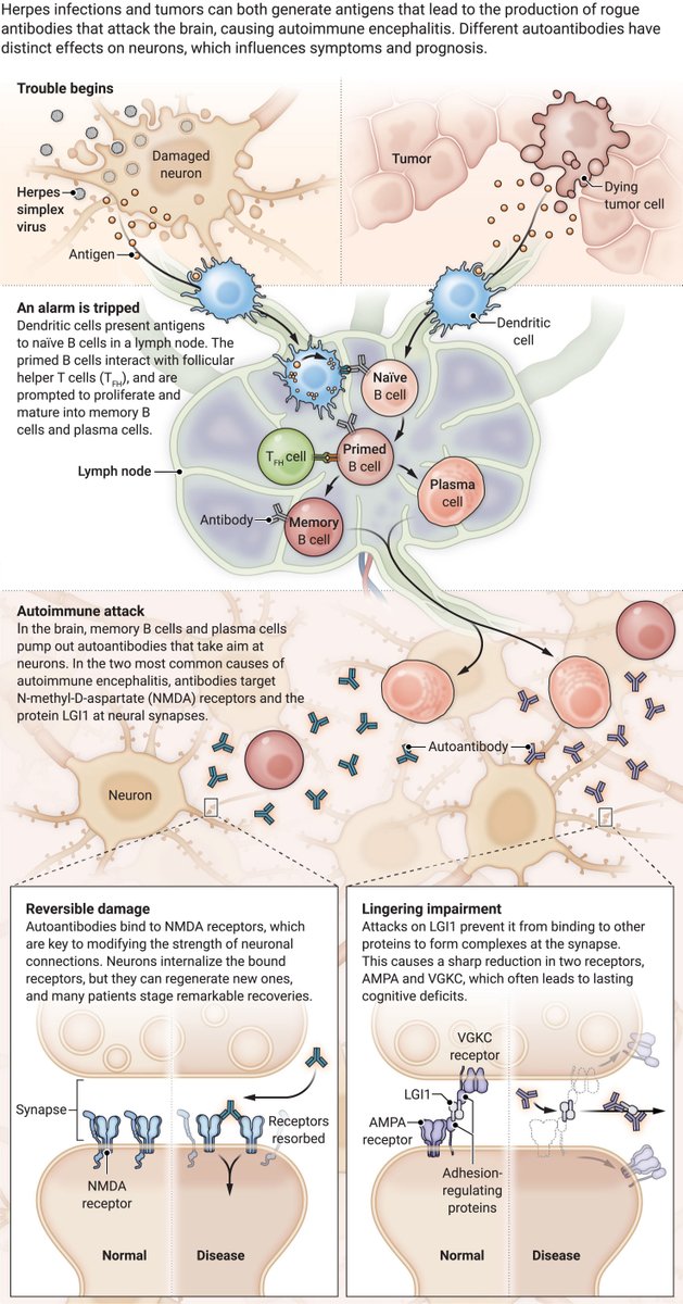 ScienceMagazine's tweet photo. Autoimmune conditions underlie some cases of psychosis. Scientists are expanding their search for patients, who often benefit from treatment.

Learn more in this @NewsfromScience feature: https://t.co/X4v4zElNwS https://t.co/AUraVx0ozP