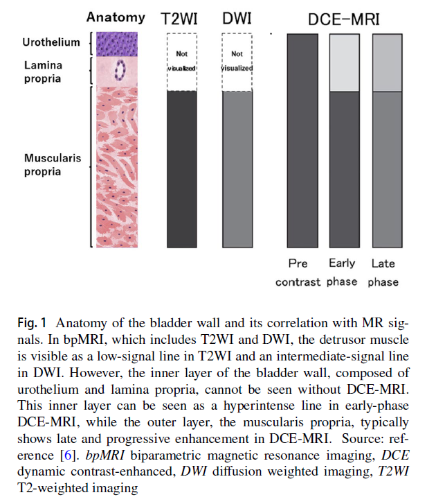 radiolobt's tweet photo. 📢 Pictorial review of multiparametric MRI in bladder urothelial carcinoma with variant histology: pearls and pitfalls
https://t.co/7iZRG1tHGD
👍Congratulations to Authors for this excellent pictorial review🎉
#CancerResearch #BladderCancer #CancerImaging https://t.co/aDjDGibWgf