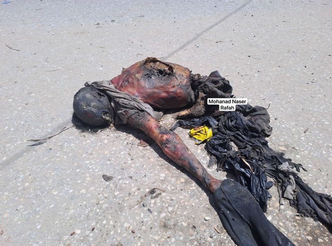 InsiderWorld_1's tweet photo. DONT LOOK AWAY!

STOP THE GENOCIDE! https://t.co/0zC8XofNs9