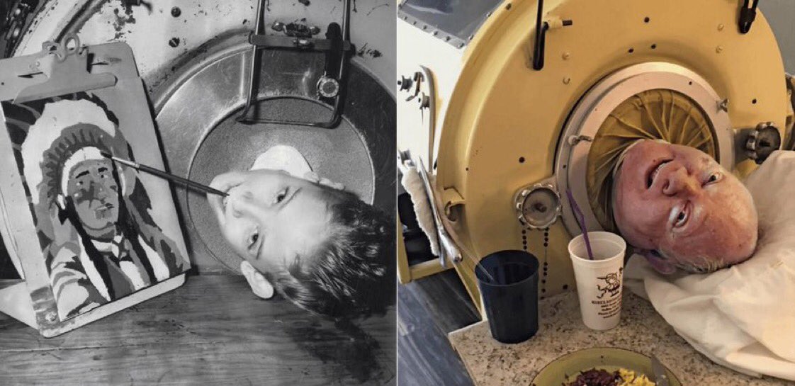MindfulReports's tweet photo. Photo of Paul Alexander as a young child and a recent photo of Paul who is now 78. He has spent most of his life inside an iron lung after he contracted polio in 1952 when he was just 6 years old. https://t.co/gXtpK0ZPwr