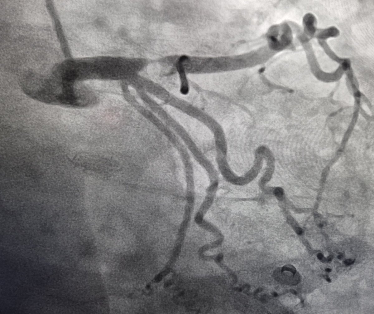 Elad Asher tweet media