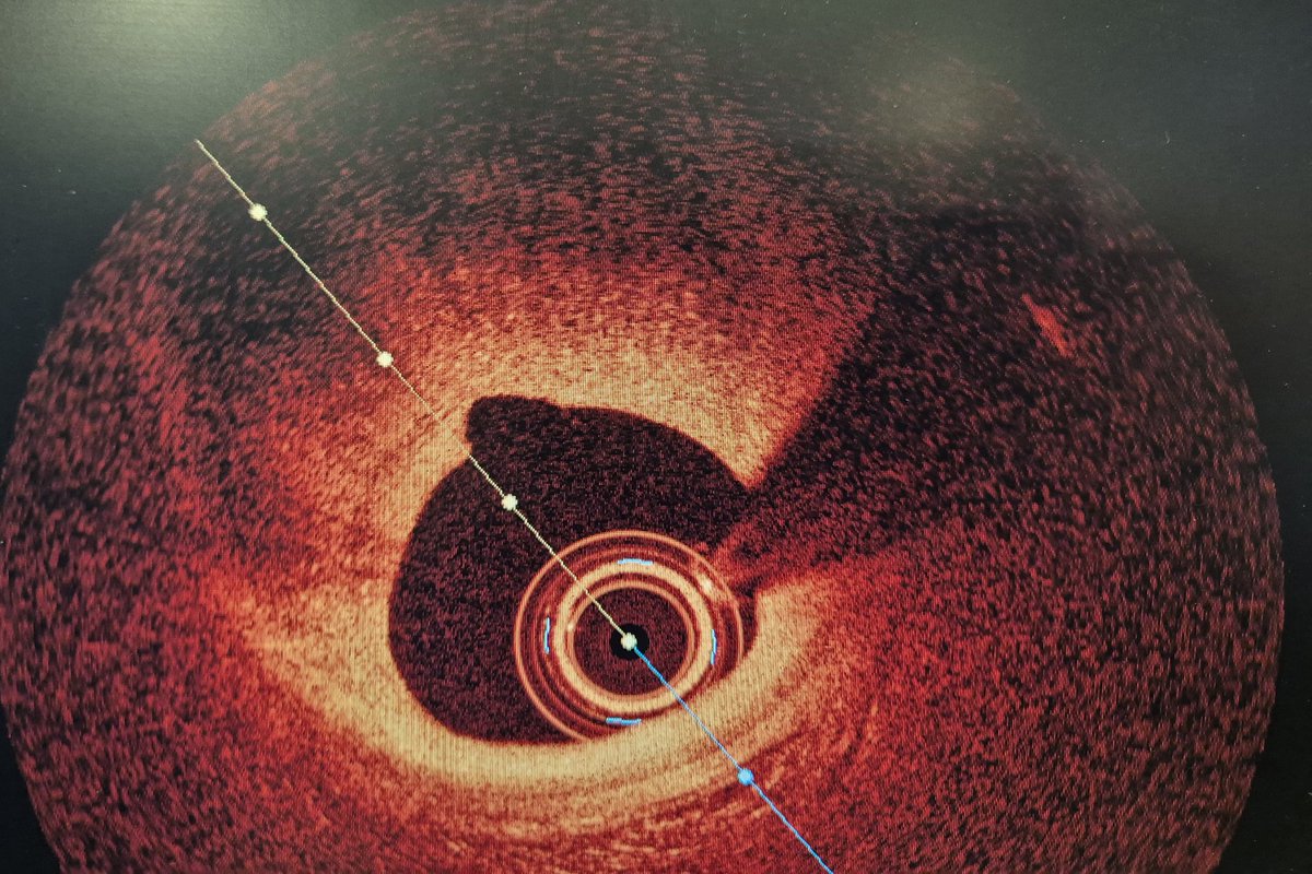 Elad Asher tweet media