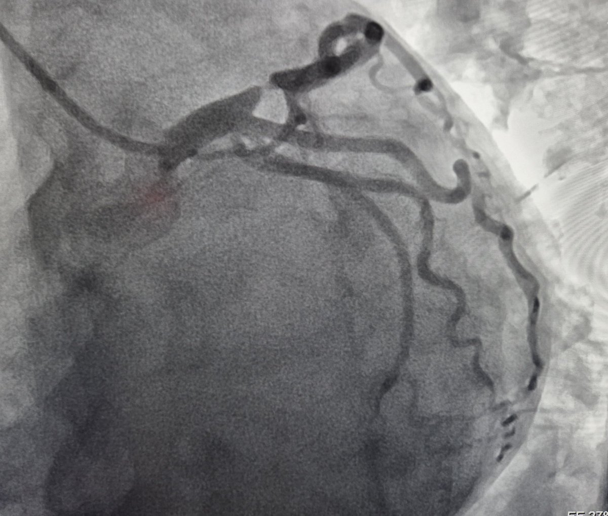 Elad Asher tweet media